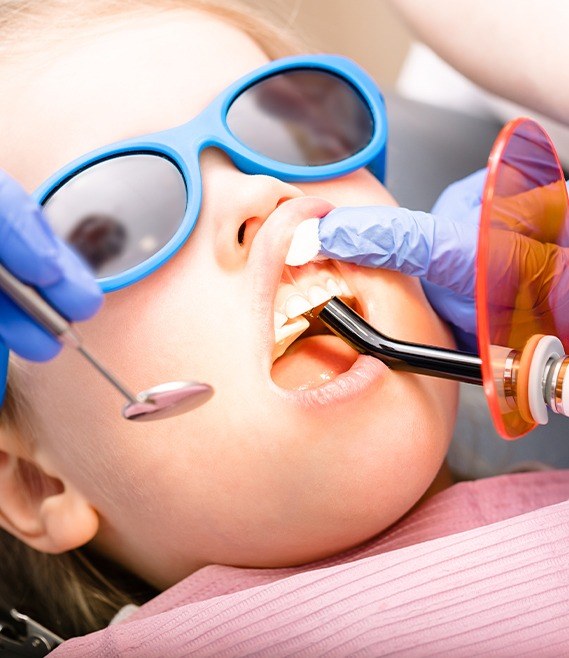 Closeup of child during dental sealant placement