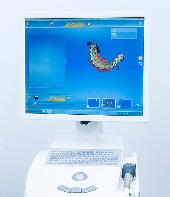 Digital images of smile on chairside computer