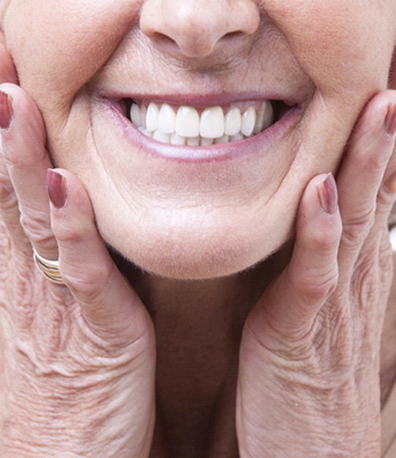 An up-close view of an older woman holding her face between her hands and smiling with new dentures in Panama City