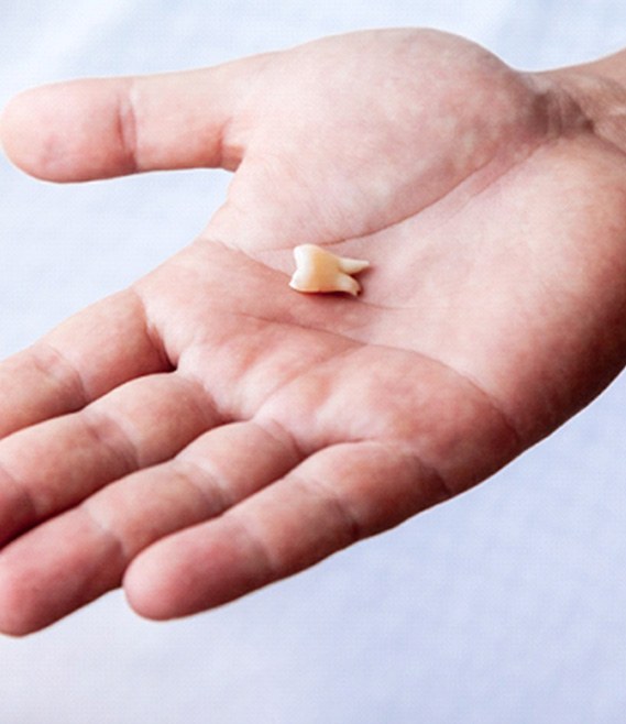 Someone holding an extracted tooth