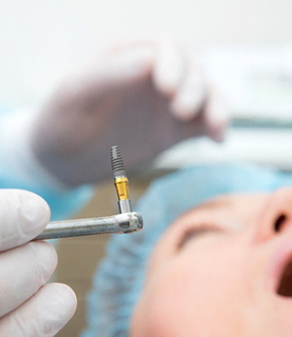 Dentist preparing to place implant in patient’s mouth