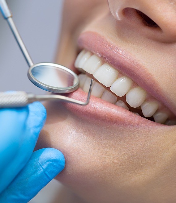 Closeup of smile during scaling and root planing gum disease treatment