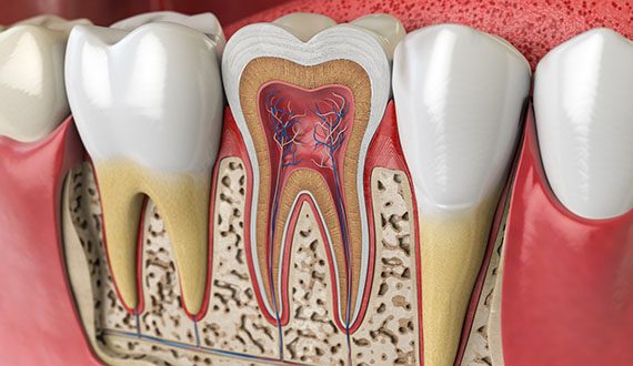 Render of inside of tooth; root canal therapy in Panama City, FL