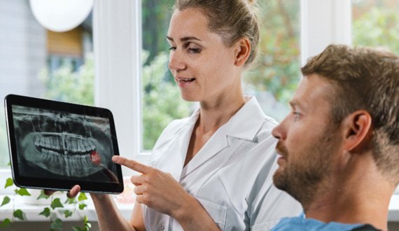 Patient listening to dentist discuss wisdom tooth extraction   
