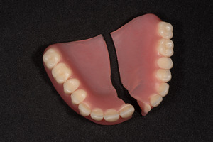 A set of broken dentures