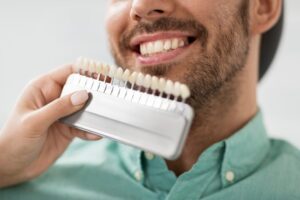 Man choosing the color of his veneers
